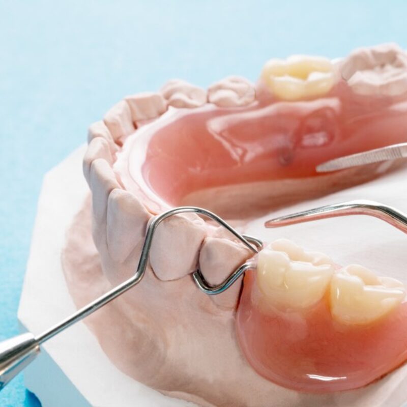 close-up-artificial-removable-partial-denture-temporary-partial-denture-blue-ground_60829-525